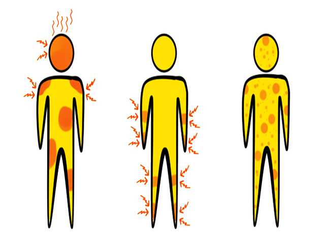 Dengue symptons